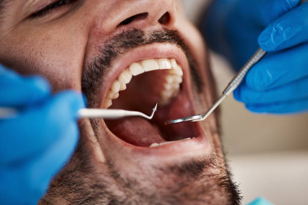 Laser Dentistry in Caddo Mills, TX
